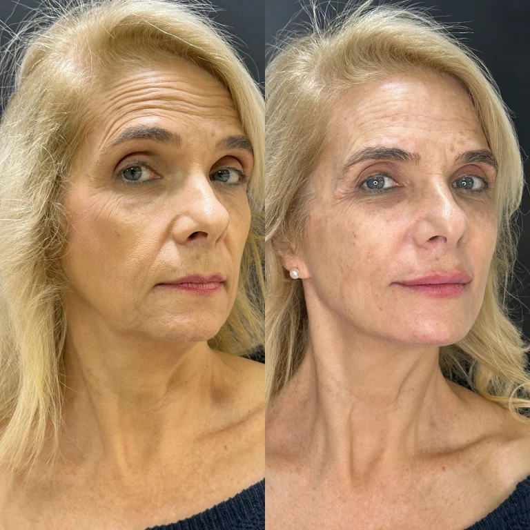 img-rejuvenescimento-