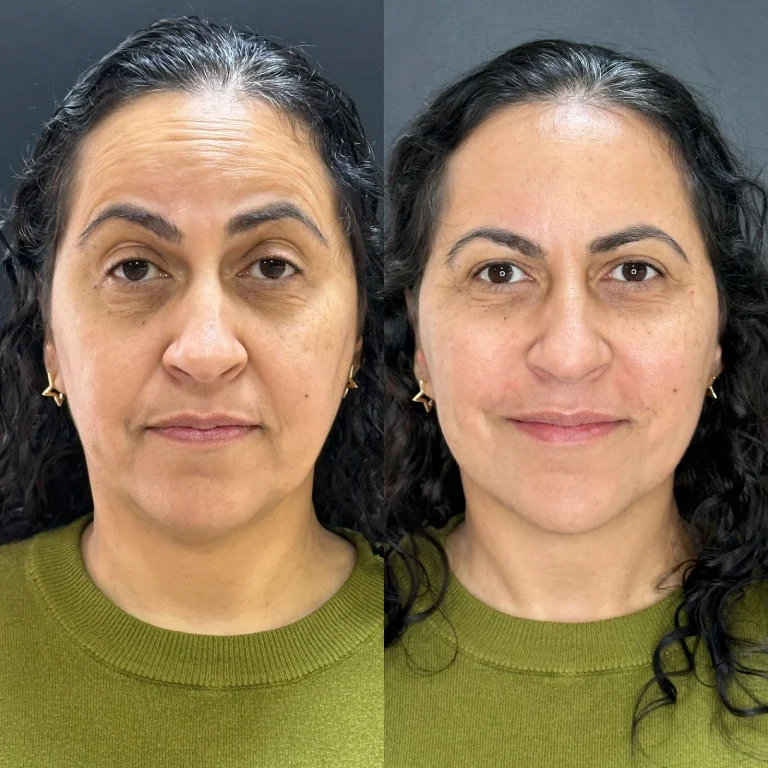 img-rejuvenescimento- (1)