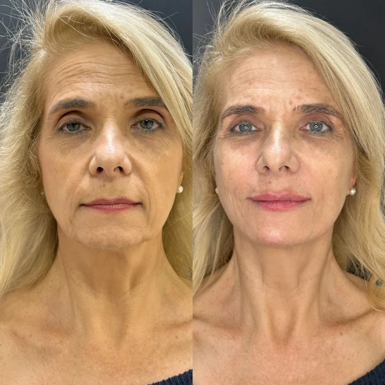 img-rejuvenescimento- (2)