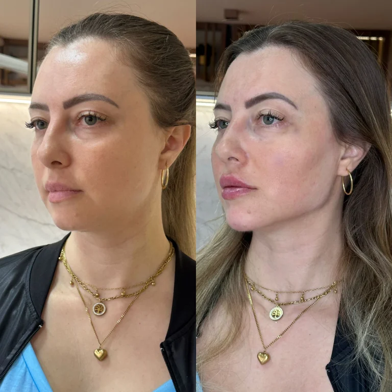 img-rejuvenescimento- (3)