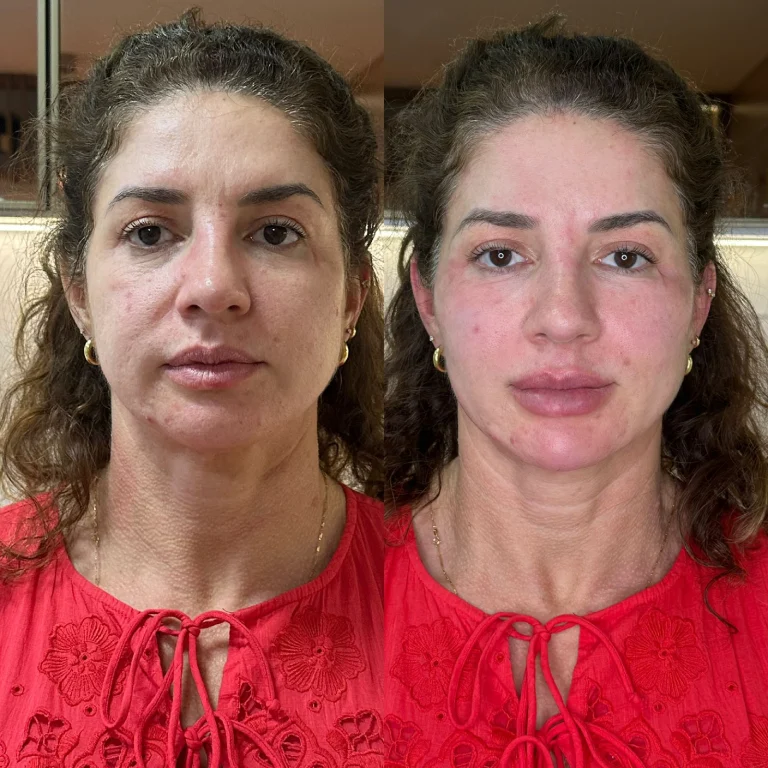 img-rejuvenescimento- (4)