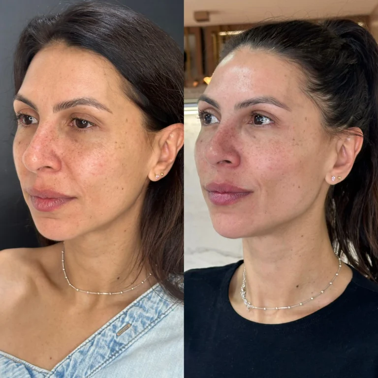 img-rejuvenescimento- (5)