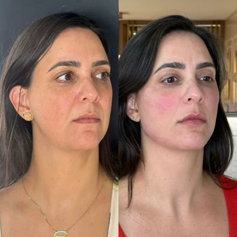 img-rejuvenescimento- (6)