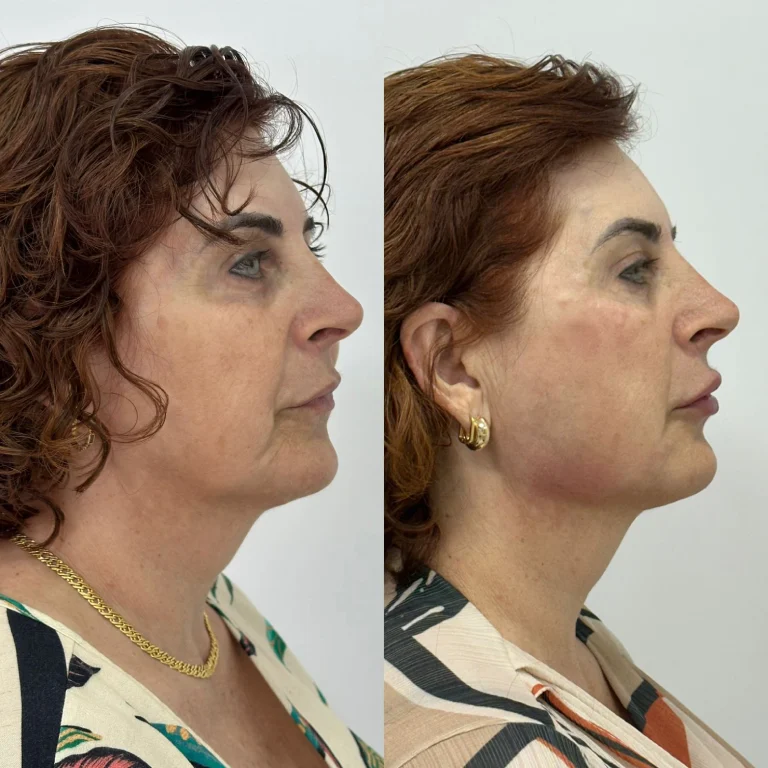 img-rejuvenescimento- (7)