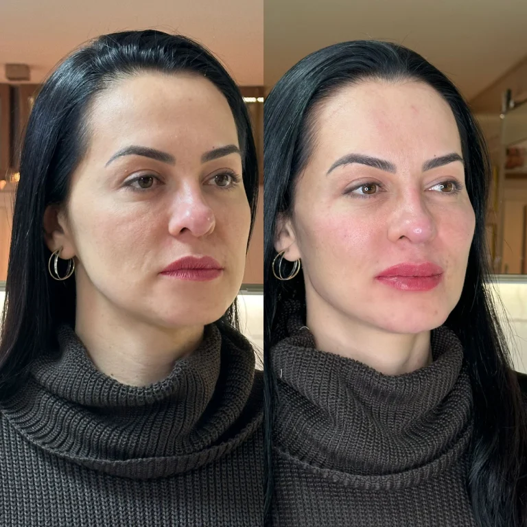 img-rejuvenescimento- (9)